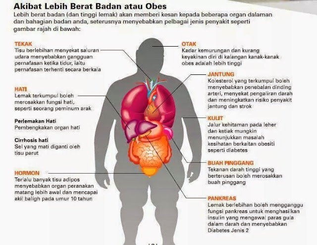 Bahaya Obesiti